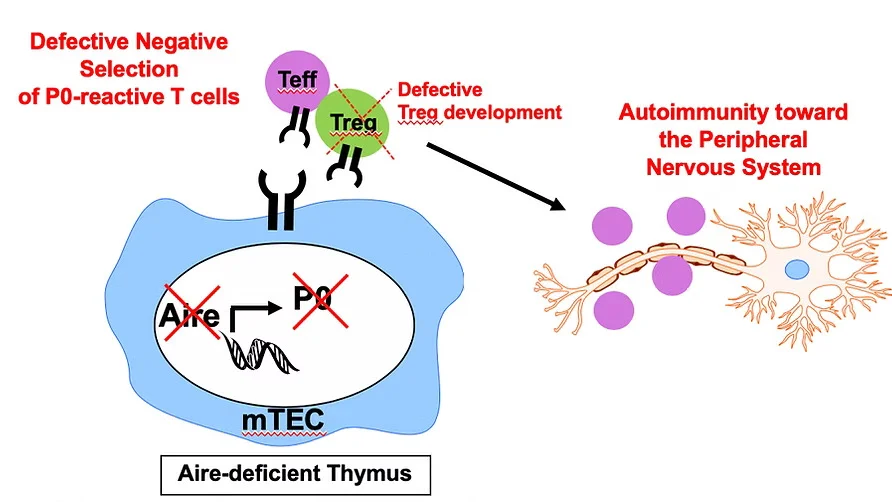 Graphical abstract illustrating how deletion of autoimmune regulator prevents antigen presentation of myelin protein zero during negative selection of T cell development. As a result, autoreactive T cells escape the thymus and cause damage to the peripheral nerves.