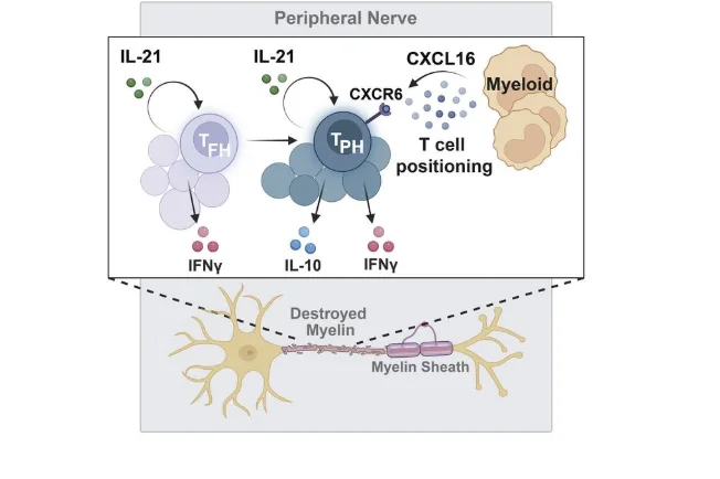 Schematic representation of a model of inflammatory neuropathy whereby CD4+ T follicular and peripheral helper cells produce proinflammatory cytokine IL-21. IL-21 signaling upregulates CXCR6 in T peripheral helper cells, a chemokine receptor that promotes T cell localization in the peripheral nerves.